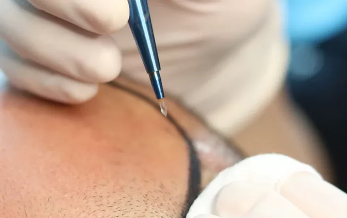 dab315 e6ef8146f9724b209e1399ade4308a4emv2