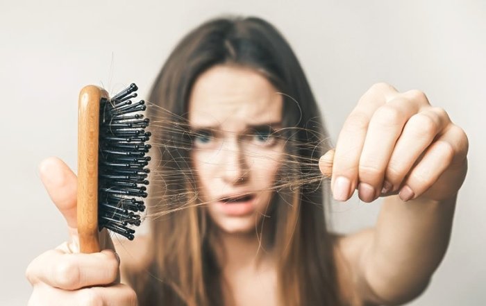 Hair Loss For Women