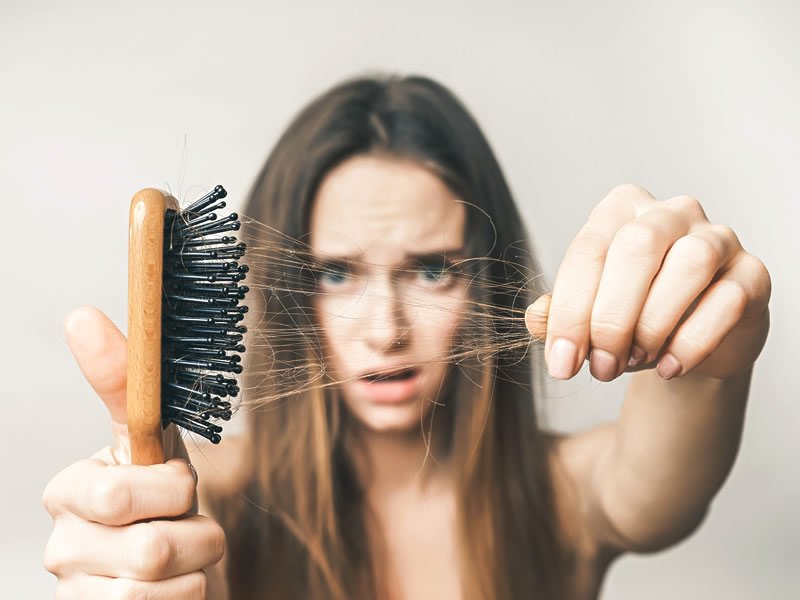 Hair Loss For Women