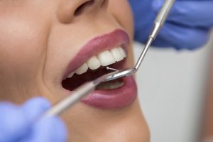 dental treatment 2022 04 19 01 56 12 utc