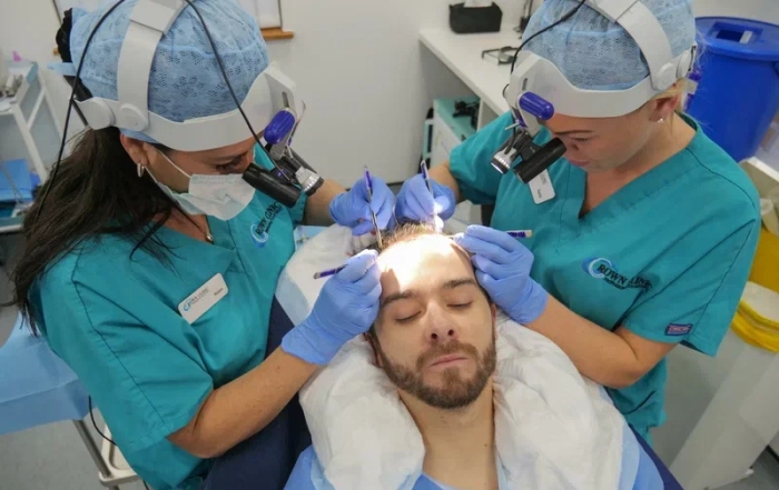 hair transplant surgery