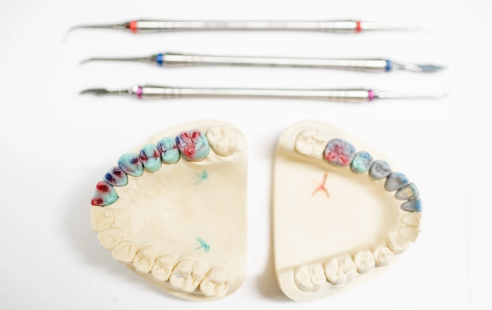 Dental Implants 1 scaled