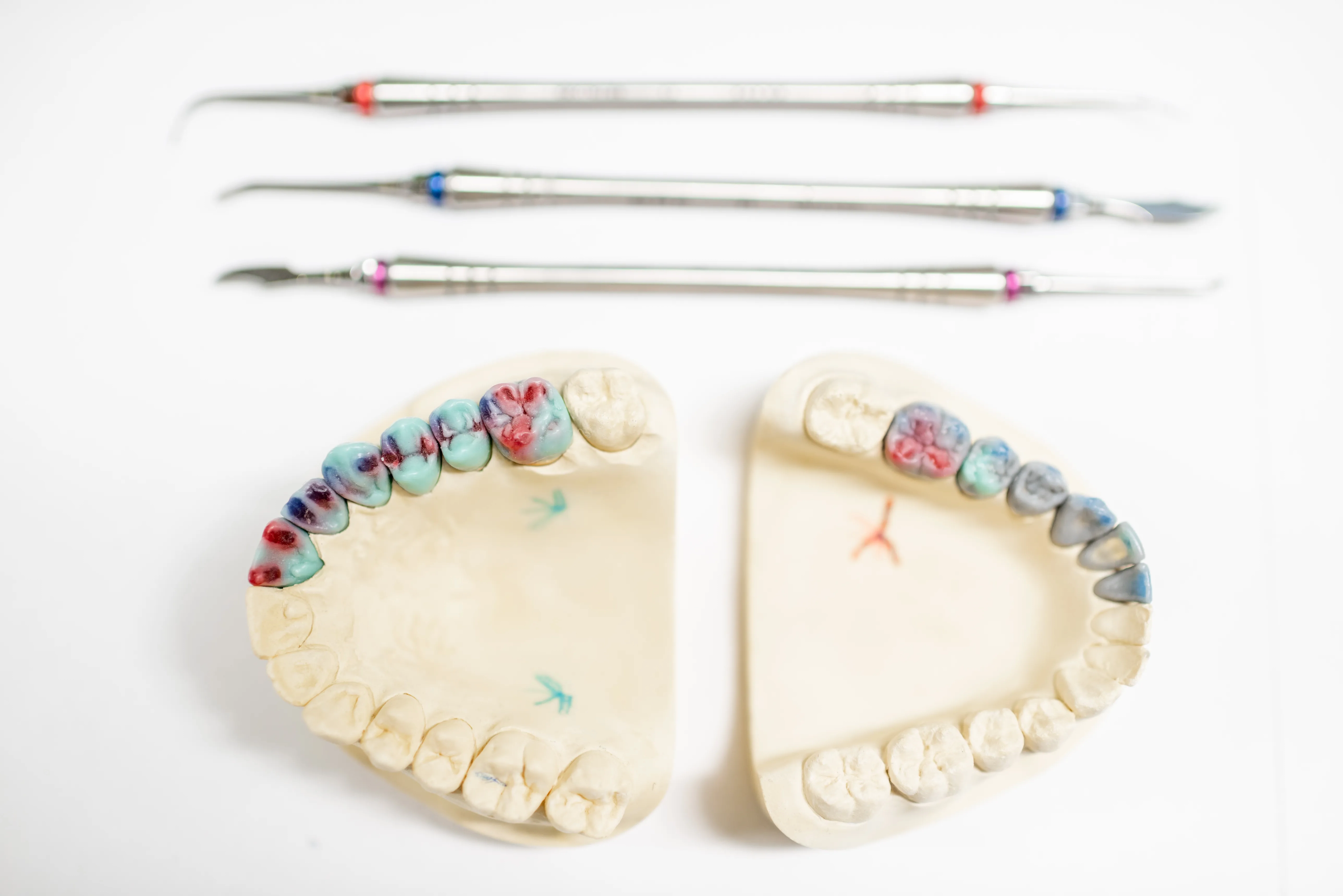 Dental Implants 1 scaled