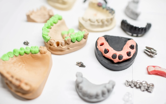 Dental Implants scaled