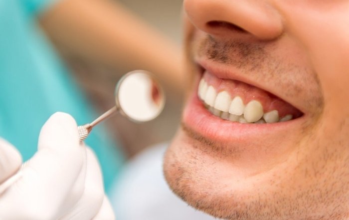 Dental Treatment