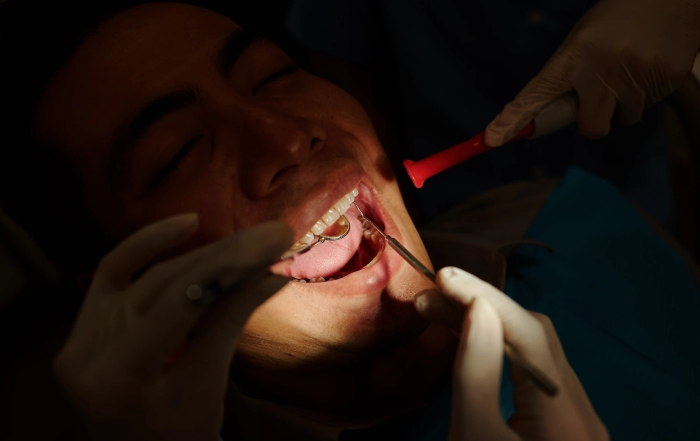 Front Teeth scaled