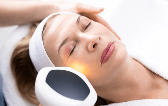 Laser Skin Resurfacing