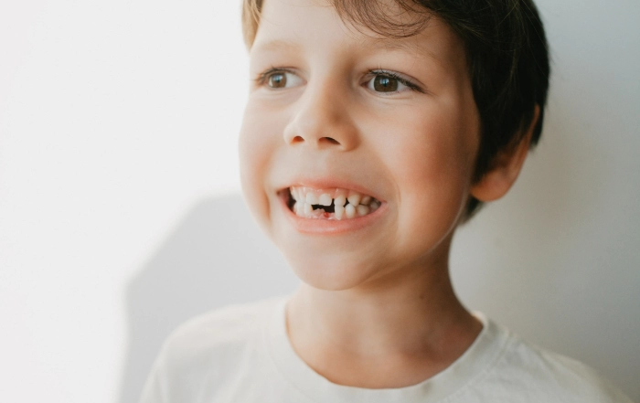 Missing Teeth scaled