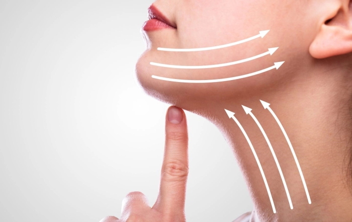 Neck Lift Surgery