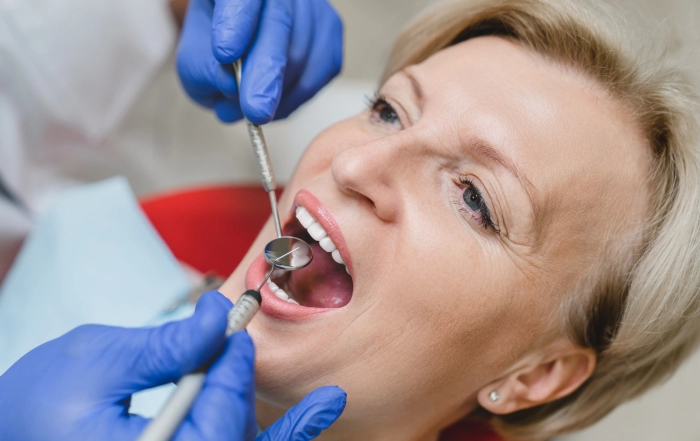 Perfect Teeth scaled