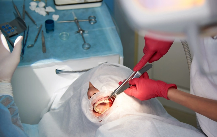 Tooth sinus scaled