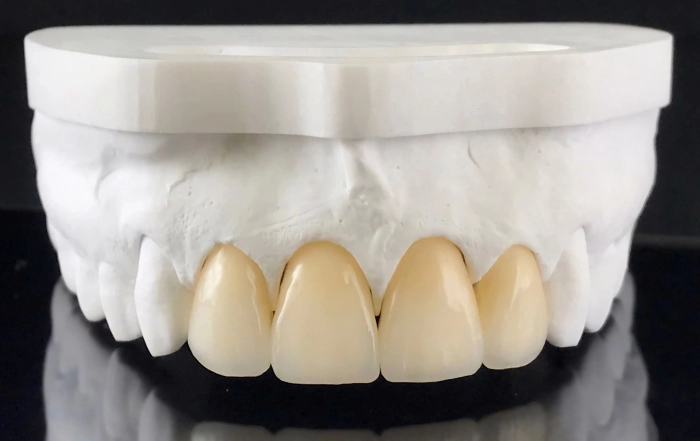 Zirconia Crowns