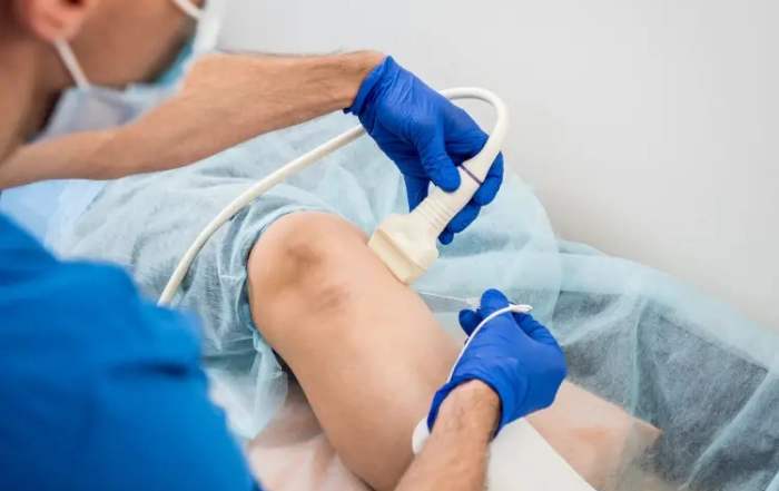 ablation