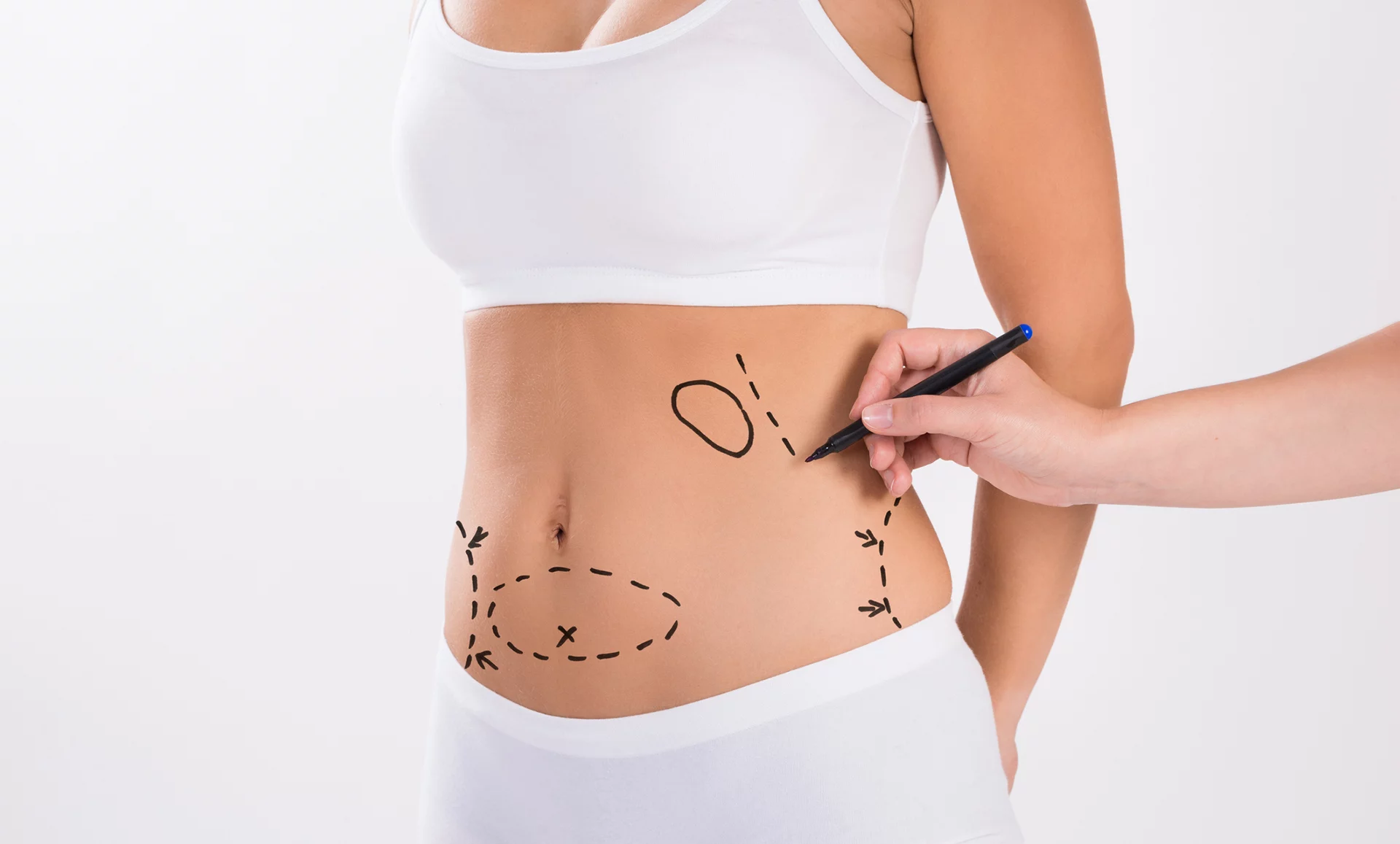 body contouring chirurgie