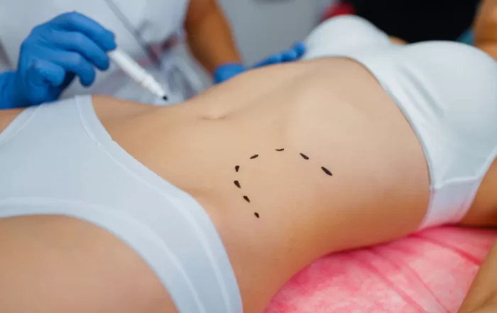 body surgery