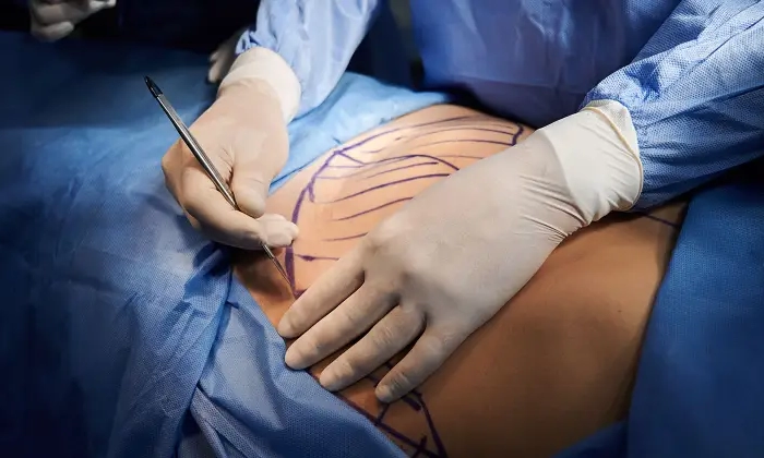 chirurgie