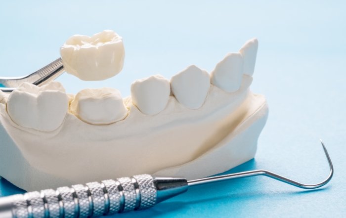 crown on a front tooth