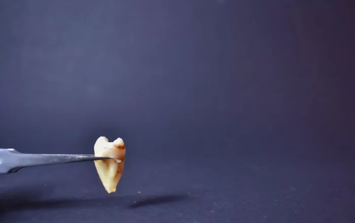 molar teeth