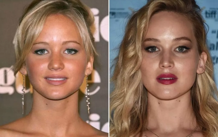 plastic surgery celebrities