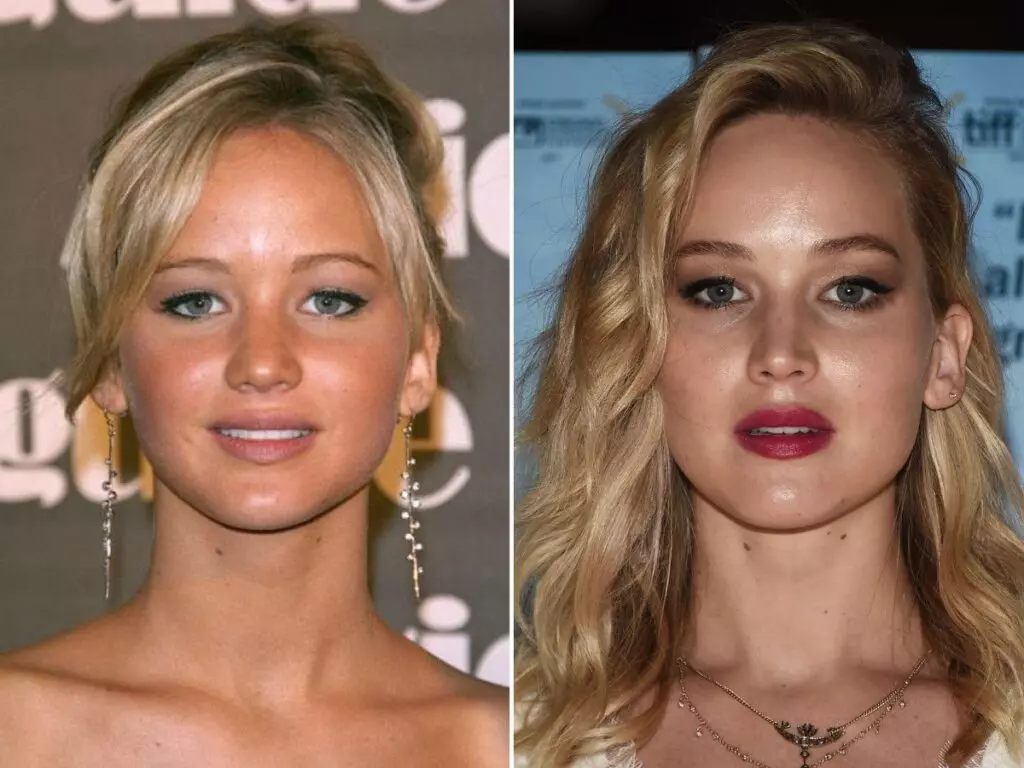 plastic surgery celebrities