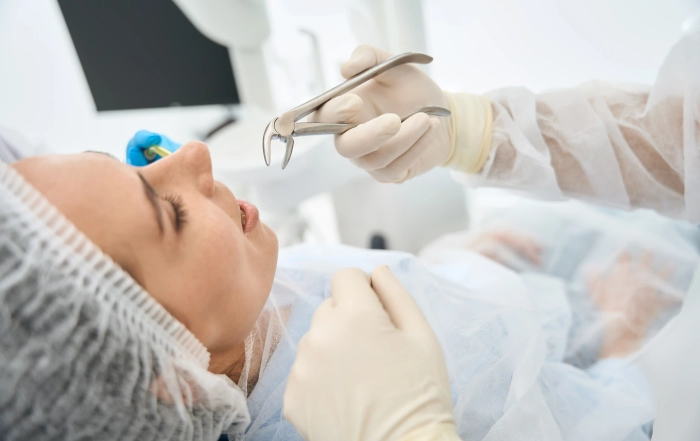 tooth extraction 3 scaled