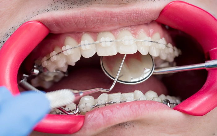 tooth inside scaled