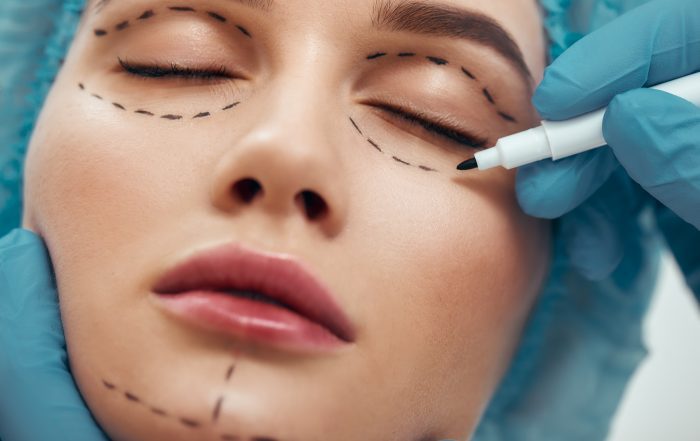 Becoming perfect. Close up photo of young woman with glowing skin in blue medical hat waiting for facial surgery while plastic surgeon in blue gloves drawing dashed line under eyes