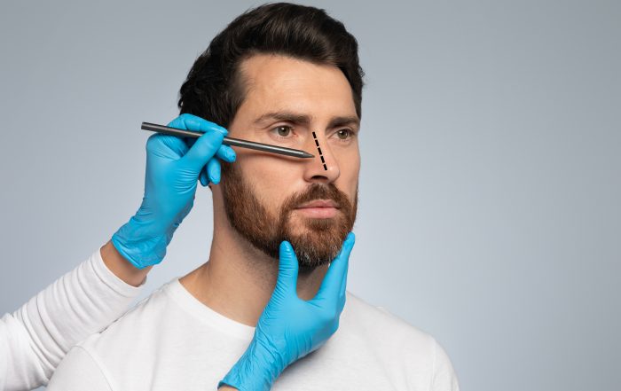 Doctor in protective gloves drawing marks on man's nose for cosmetic surgery operation, grey background