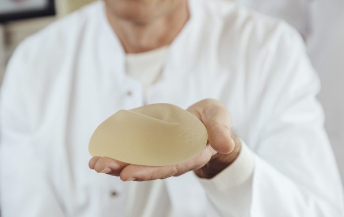 Doctor showing a silicone breast implant