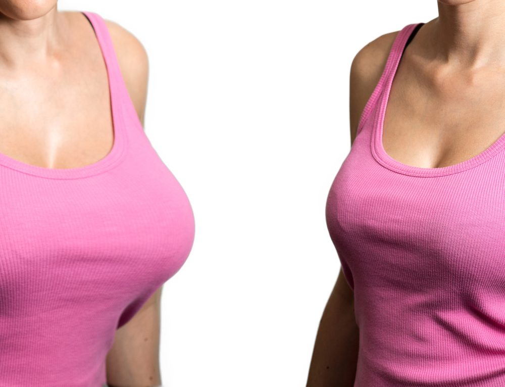 Want To Know More About Breast Augmentation Dont Miss Out Cades Clinic 4401