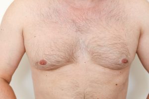 Close up of hairy man's chest, male nipples, light thin hair on breast unrecognisable young guy. White skin with birthmarks. Overweight, not slim