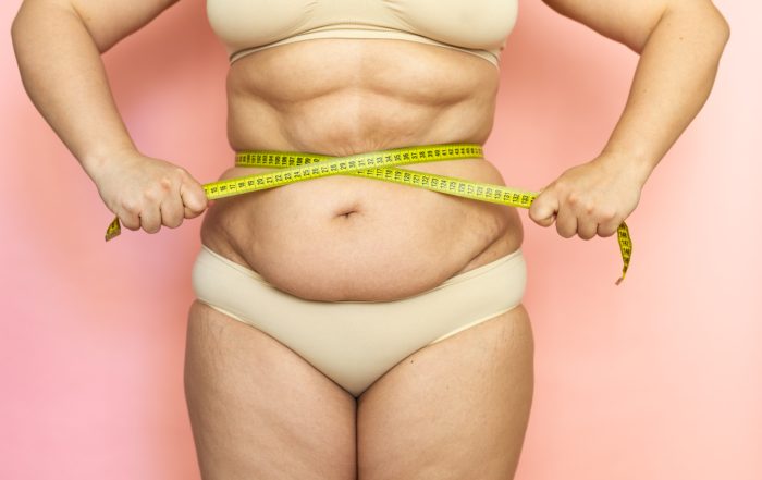 Cropped overweight naked after birth woman tummy, measuring her waistline by tape. Fat abdomen, sagging excess folds