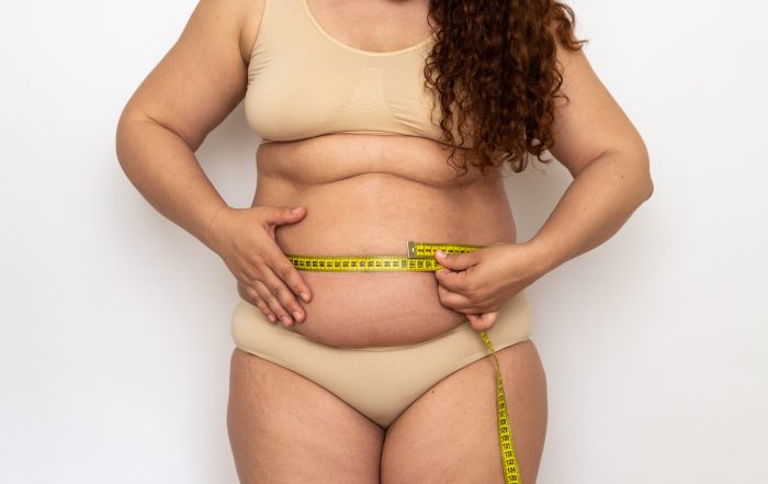 Portrait of shocked plump middle aged woman with curly hair wearing beige underwear, measuring waist with yellow tape.