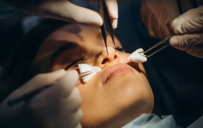 Surgeon and his assistant performing cosmetic surgery on nose in hospital operating room. Nose reshaping, augmentation. Rhinoplasty.