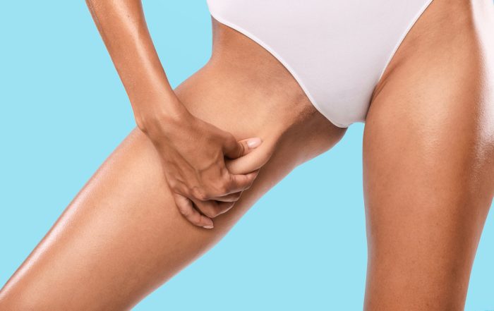 Unrecognizable young woman pinching her inner thigh, examining cellulite