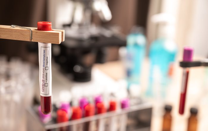 Blood sample test tube for COVID 19 in Laboratory