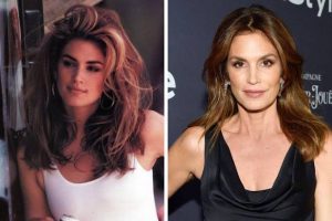 Cindy Crawford, now and then, botox, plastic surgery