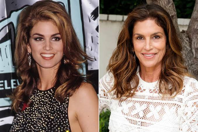 Cindy Crawford, plastic surgery, botox, face, istanbul