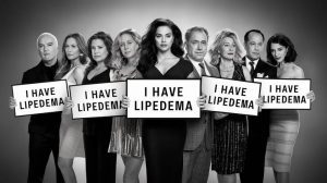 celebrities lipedema, liposuction