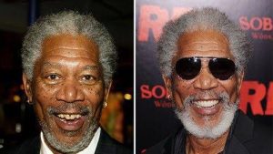 Morgan Freeman, Hollywood smile, smile makeover, istanbul, cades clinic