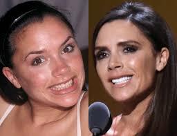 Victoria Beckham, Hollywood smile, smile makeover, istanbul, cades clinic