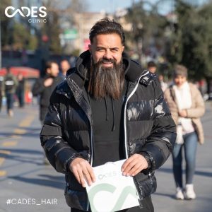 Bilal, hair transplant, istanbul, cades clinic