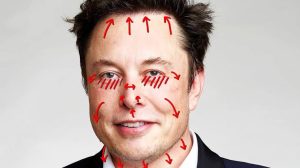 Elon Musk, Plastic Surgery, Hair Transplant, Rhinoplasty, Istanbul