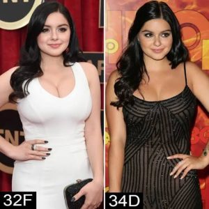 Ariel Winter, breast reduction