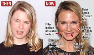 Renée Zellweger, plastic surgery