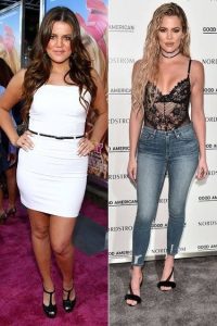 Khloé Kardashian, plastic surgery, liposuction, body contouring