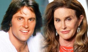 Caitlyn Jenner, transgender surgery, before and after