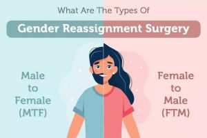 Transgender surgery