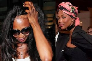 Naomi Campbell, hair transplant